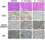 CD31 Antibody in Immunohistochemistry (IHC)