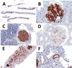 DNAJB9 Antibody in Immunohistochemistry (IHC)