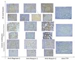 RC3H2 Antibody in Immunohistochemistry (IHC)