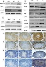 SPECC1L Antibody in Western Blot (WB)