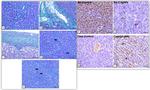 Caspase 3 Antibody in Immunohistochemistry (IHC)