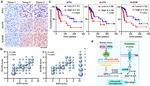 GLUT5 Antibody in Immunohistochemistry (IHC)