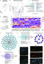 ZEB1 Antibody in Immunocytochemistry (ICC/IF)