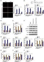 NOX4 Antibody in Western Blot (WB)