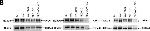 Rabbit IgG (H+L) Secondary Antibody in Western Blot (WB)