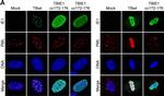 Rabbit IgG (H+L) Highly Cross-Adsorbed Secondary Antibody in Immunocytochemistry (ICC/IF)