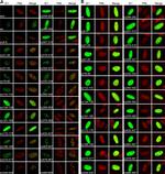 Rabbit IgG (H+L) Highly Cross-Adsorbed Secondary Antibody in Immunocytochemistry (ICC/IF)