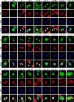 Rabbit IgG (H+L) Highly Cross-Adsorbed Secondary Antibody in Immunocytochemistry (ICC/IF)