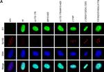 Rabbit IgG (H+L) Highly Cross-Adsorbed Secondary Antibody in Immunocytochemistry (ICC/IF)