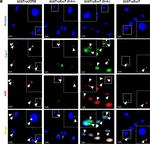 Mouse IgG (H+L) Cross-Adsorbed Secondary Antibody in Immunocytochemistry (ICC/IF)