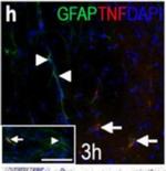 Rabbit IgG (H+L) Cross-Adsorbed Secondary Antibody in Immunohistochemistry (IHC)