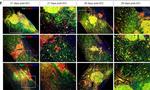 Rat IgG (H+L) Cross-Adsorbed Secondary Antibody in Immunohistochemistry (IHC)