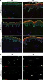 CD254 (RANK Ligand) Antibody in Immunohistochemistry (IHC)