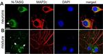 Mouse IgG (H+L) Cross-Adsorbed Secondary Antibody in Immunocytochemistry (ICC/IF)