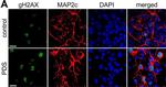 Rabbit IgG (H+L) Cross-Adsorbed Secondary Antibody in Immunocytochemistry (ICC/IF)