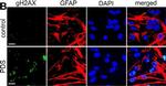 Rabbit IgG (H+L) Cross-Adsorbed Secondary Antibody in Immunocytochemistry (ICC/IF)