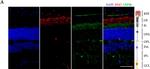 Rabbit IgG (H+L) Cross-Adsorbed Secondary Antibody in Immunohistochemistry (IHC)