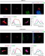 Rabbit IgG (H+L) Cross-Adsorbed Secondary Antibody in Immunocytochemistry (ICC/IF)