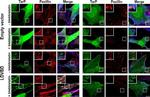 Rabbit IgG (H+L) Highly Cross-Adsorbed Secondary Antibody in Immunocytochemistry (ICC/IF)