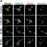 Rabbit IgG (H+L) Cross-Adsorbed Secondary Antibody in Immunocytochemistry (ICC/IF)