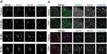 Rabbit IgG (H+L) Cross-Adsorbed Secondary Antibody in Immunocytochemistry (ICC/IF)