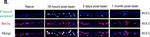 Mouse IgG (H+L) Cross-Adsorbed Secondary Antibody in Immunohistochemistry (Frozen) (IHC (F))