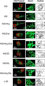 Rabbit IgG (H+L) Cross-Adsorbed Secondary Antibody in Immunocytochemistry (ICC/IF)