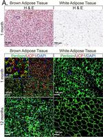 Mouse IgG (H+L) Cross-Adsorbed Secondary Antibody in Immunohistochemistry (Paraffin) (IHC (P))