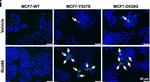 Rabbit IgG (H+L) Cross-Adsorbed Secondary Antibody in Immunocytochemistry (ICC/IF)