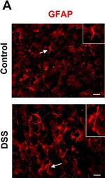 Rabbit IgG (H+L) Cross-Adsorbed Secondary Antibody in Immunohistochemistry (Frozen) (IHC (F))