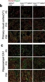 Guinea Pig IgG (H+L) Highly Cross-Adsorbed Secondary Antibody in Immunohistochemistry (PFA fixed) (IHC (PFA))