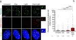 Rabbit IgG (H+L) Cross-Adsorbed Secondary Antibody in Immunocytochemistry (ICC/IF)