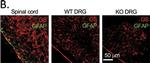 Rabbit IgG (H+L) Highly Cross-Adsorbed Secondary Antibody in Immunohistochemistry (Paraffin) (IHC (P))