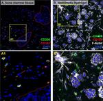 Rabbit IgG (H+L) Highly Cross-Adsorbed Secondary Antibody in Immunohistochemistry (Paraffin) (IHC (P))