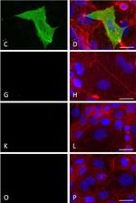 Mouse IgG (H+L) Highly Cross-Adsorbed Secondary Antibody in Immunocytochemistry (ICC/IF)