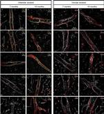 Mouse IgG (H+L) Highly Cross-Adsorbed Secondary Antibody in Immunohistochemistry (IHC)