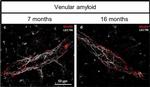 Mouse IgG (H+L) Highly Cross-Adsorbed Secondary Antibody in Immunohistochemistry (IHC)