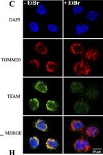 Rabbit IgG (H+L) Highly Cross-Adsorbed Secondary Antibody in Immunocytochemistry (ICC/IF)