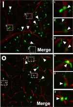 Goat IgG (H+L) Highly Cross-Adsorbed Secondary Antibody in Immunohistochemistry (Paraffin) (IHC (P))