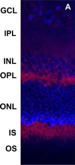 Rabbit IgG (H+L) Highly Cross-Adsorbed Secondary Antibody in Immunohistochemistry (PFA fixed) (IHC (PFA))