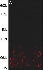 Rabbit IgG (H+L) Highly Cross-Adsorbed Secondary Antibody in Immunohistochemistry (PFA fixed) (IHC (PFA))