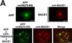 Rabbit IgG (H+L) Highly Cross-Adsorbed Secondary Antibody in Immunocytochemistry (ICC/IF)