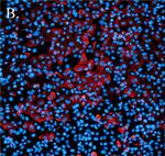 Rabbit IgG (H+L) Highly Cross-Adsorbed Secondary Antibody in Immunocytochemistry (ICC/IF)