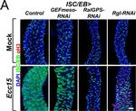 Rabbit IgG (H+L) Highly Cross-Adsorbed Secondary Antibody in Immunocytochemistry (ICC/IF)