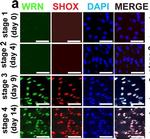 Rabbit IgG (H+L) Highly Cross-Adsorbed Secondary Antibody in Immunocytochemistry (ICC/IF)