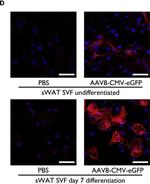 Rabbit IgG (H+L) Highly Cross-Adsorbed Secondary Antibody in Immunohistochemistry (Paraffin) (IHC (P))