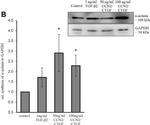 Rabbit IgG (H+L) Highly Cross-Adsorbed Secondary Antibody in Western Blot (WB)