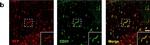 Rat IgG (H+L) Highly Cross-Adsorbed Secondary Antibody in Immunohistochemistry (Frozen) (IHC (F))