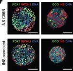 Mouse IgG (H+L) Highly Cross-Adsorbed Secondary Antibody in Immunohistochemistry (Paraffin) (IHC (P))