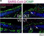 Rabbit IgG (H+L) Highly Cross-Adsorbed Secondary Antibody in Immunohistochemistry (IHC)